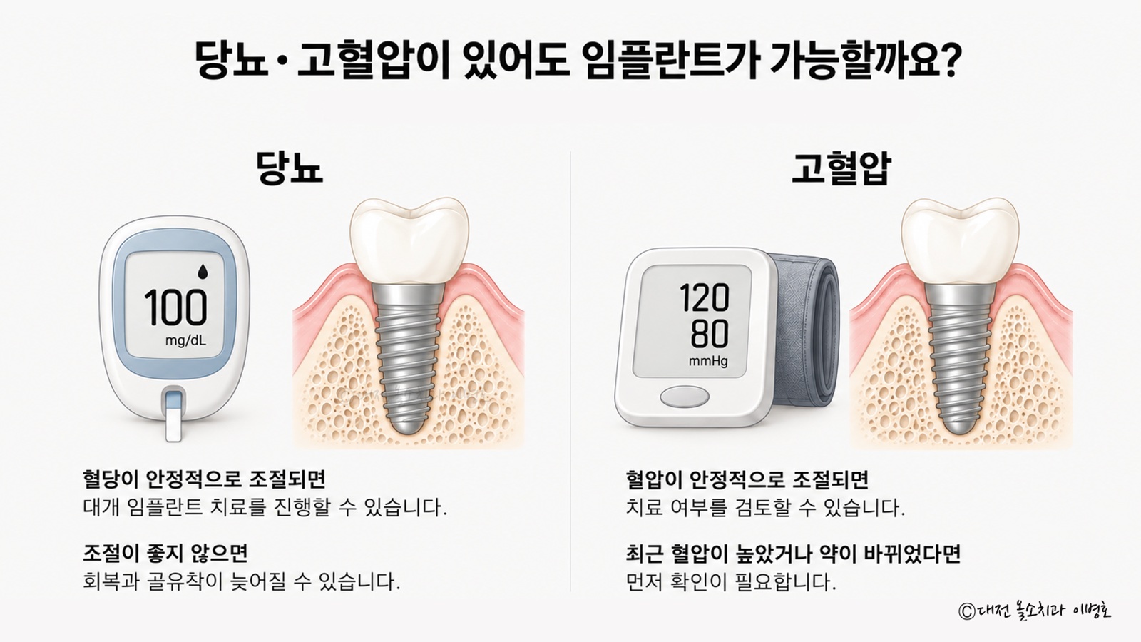당뇨와 고혈압이 있을 때 혈당·혈압 조절 상태에 따라 임플란트 치료를 검토하는 기준을 정리한 그림